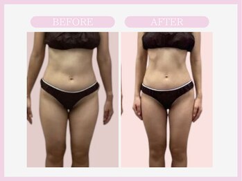 スリムライン 青森店(The Slim Line)/before→after