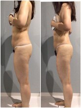 fallon beauty　痩身/フェイシャル/フェム・オムケア/アロマ/ボディケア/痩身キャビMAX