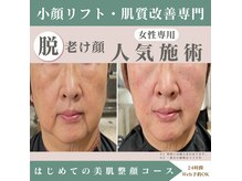 整顔院 経堂店の雰囲気（脱老け顔）