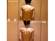 凪 横浜の雰囲気（肩こり、首の疲れ、つまりを取り除き、360度綺麗に。１回）