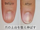 爪がこんなに大きく成長