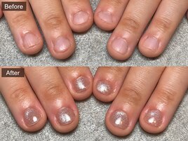 人気の深爪ケアコース￥9,980