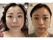 ランスソア(L'ins soi)/