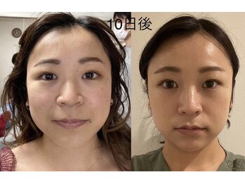 ランスソア(L'ins soi)/