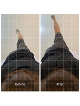 ナオル整体 恵比寿院(NAORU整体)/恵比寿/整体施術事例【股関節】