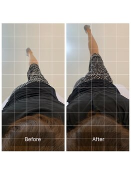 ナオル整体 恵比寿院(NAORU整体)/恵比寿/整体施術事例【股関節】