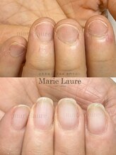 マリーロール 淀屋橋本店(Marie Laure)/自爪育成/深爪矯正/ネイルケア