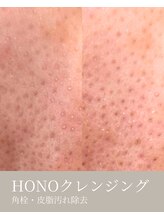 エムネ ラボ 大阪本町(M/NE &nbsp;LAB)/この角栓クレンジングヤバイです