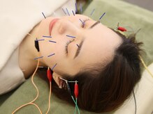 丸太町骨盤整骨院 鍼灸院/電気美容鍼
