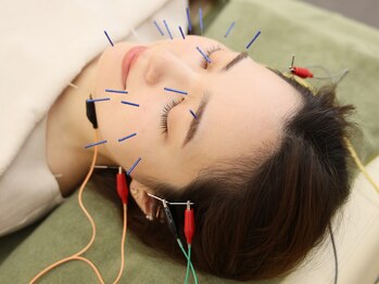 丸太町骨盤整骨院 鍼灸院/電気美容鍼