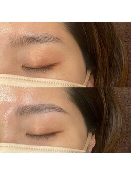 エールバイボヌール(Ere by Bonheur)/hollywood brow lift
