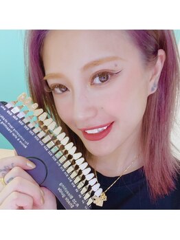 ホワイトニングルーム 横浜店(Whitening Room)/モデル SENA様