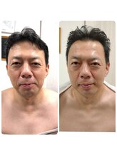 ビエストラ(Biestora)/