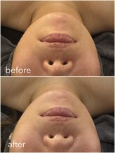 ワッカスタンド(〇 STAND)/レモンボトルbefore→after