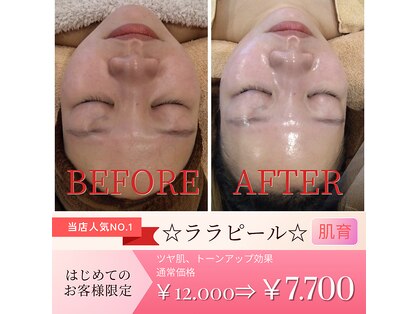 エムグランデ(Mgrande)の写真