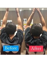 ナオル整体 宮崎院(NAORU整体)/50代男性施術事例【肩痛改善】