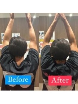 ナオル整体 宮崎院(NAORU整体)/50代男性施術事例【肩痛改善】