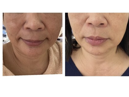 オリーブ(Olive)の写真