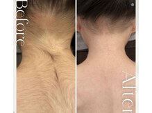 モアトゥインクル 東広島西条店(MORE twinkle)