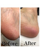 カーニバルマニア 三田店(Carnival Mania)/育爪フットケア＆足裏角質ケア