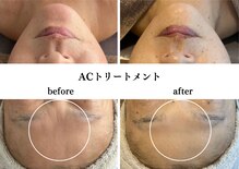 ブリエ 自由が丘(briller)