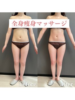 モンレーヴ(MonReve)/全身痩身ハンドマッサージ