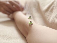 ロミアオ(Lomi-AO)/腕にせんねん灸(台座付きのお灸)