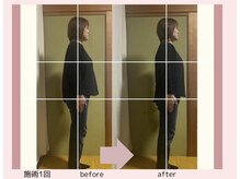 エージー(AG)/骨盤矯正＋フェムケア矯正