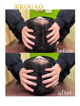 鶴見区徳庵わだち整骨院/美小顔矯正ビフォーアフター