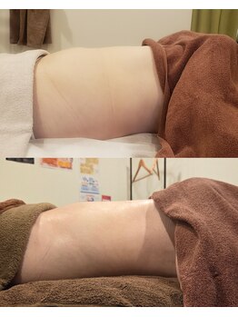 トータルエステティック ジョワイユ(JOYEUX)/3ヵ月集中お腹ケア