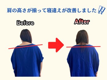 アオ(ao)/整体 Before→After