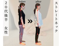 姿勢を分析しあなたに合ったプログラムを構成/名古屋/千種区