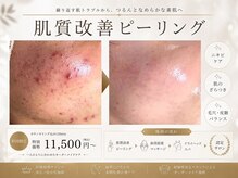 マイナプラ 表参道(myna+)
