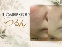 レア(Le'a)の雰囲気（剥離なしで毛穴の開きや詰まりを優しく整え、つるん肌へ導きます）