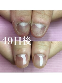 イリスネイル(IRIS NAIL)/