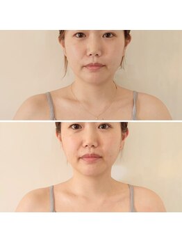 コガオテテ(Kogao tete)/スタッフもきれいに!