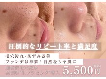 ミュー 名東一社店(mieux)