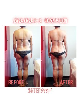 ビューティサロン キヨの部屋(beauty salon)/【ぷよぷよ浮腫みさんコース】