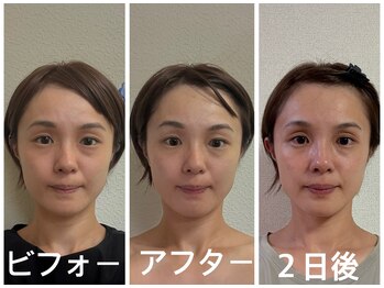 アクアナチュラ(ACQUANATURA)/全体的にスッキリしました