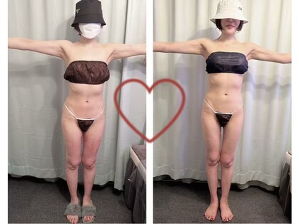 ハレ 麻布十番(Hare)の写真