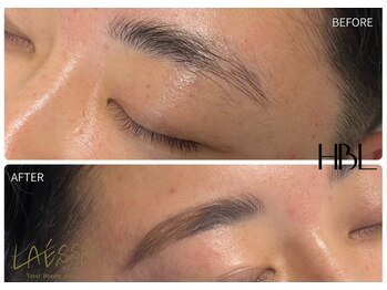 ラエッセ(LAESSE)/ハリウッドブロウリフト