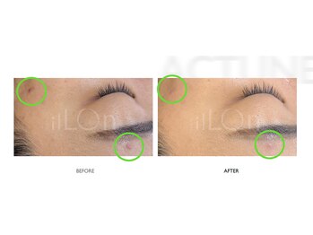 サロンドオフ 御堂筋店(salon de off)/