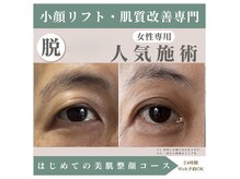 整顔院 経堂店の雰囲気（たるみ改善）