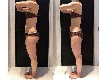 リボディ 表参道(An re Body)/before→after