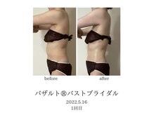 オン(On)/バザルトボディ１回目施術