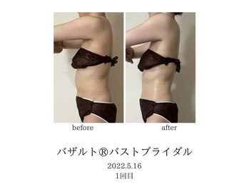 オン(On)/バザルトボディ１回目施術