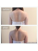 トータルビューティサロン リボーテ(Re:Beaute)/背中痩せ　ブライダルエステ
