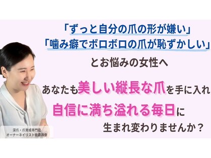 ティンブレの写真