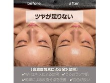 モアナ(Moana)/乾燥敏感肌を卒業！
