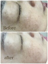 フェアリーヘア ニーナ(Fairy Hair Ni-na)/ハイドロジェリーマスクが優秀！